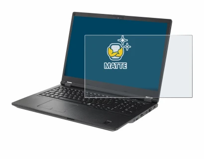 Imagen del dispositivo Fujitsu Lifebook U7511 con una amplia variedad de protectores de pantalla.
