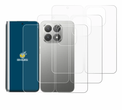 Imagen del dispositivo Xiaomi 15T (Frontal+Trasero) con una amplia variedad de protectores de pantalla.