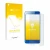 Parte frontal de un envase de producto con el logotipo de la marca upscreen. Al lado se muestra el dispositivo Honor 9 con su 