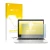 Parte frontal de un envase de producto con el logotipo de la marca upscreen. Al lado se muestra el dispositivo HP ProBook 450 