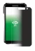 Imagen del dispositivo Soyes S10 Max con una amplia variedad de protectores de pantalla.